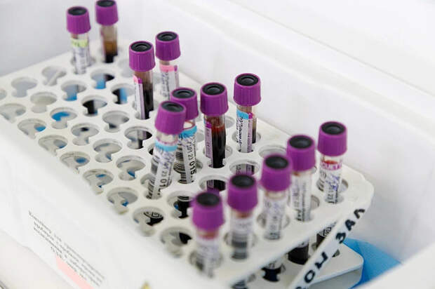 Девять тысяч туляков сдали более 21 тысячи литров крови в 2025 году