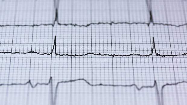 «Многие жалуются»: кардиолог рассказала о влиянии COVID-19 на сердце