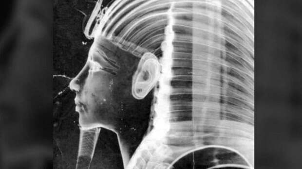 Золотая маска фараона Тутанхамона под рентгеновскими лучами