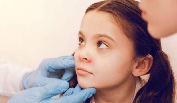 Ретинобластома — это… Определение, описание заболевания с фото, причины появления, симптомы, особенности диагноза и лечение