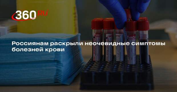 Гематолог Минздрава Паровичникова перечислила признаки проблем с кровью