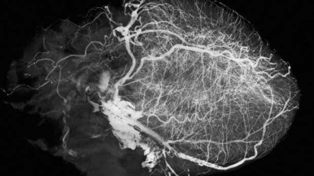 Что нужно знать о МР-ангиографии сердца