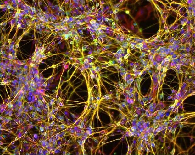 Нейроны - нервные клетки человека