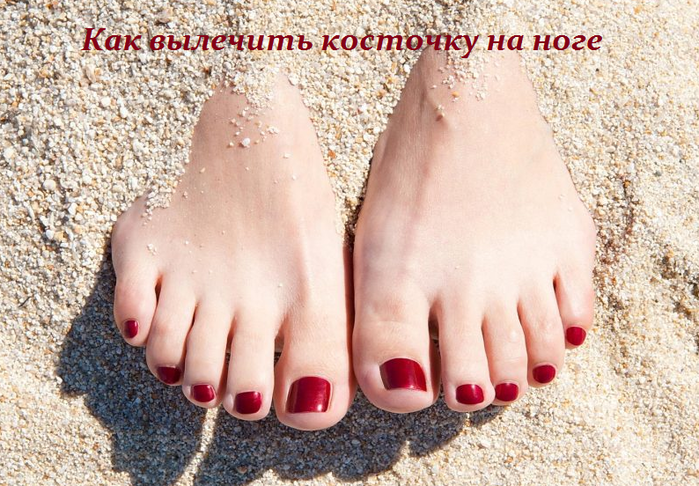 2749438_Kak_vilechit_kostochky_na_noge (700x486, 677Kb)