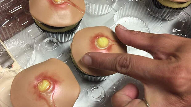 Pimple Cupcakes With Squeezable Heads Are A Thing Now (Unfortunately)