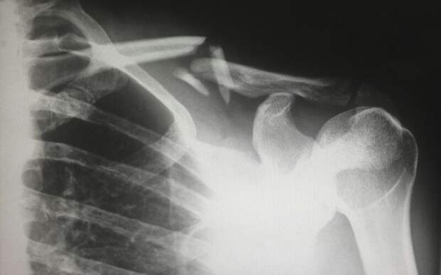 В Москве внедрят анализ рентгеновских снимков без участия врача