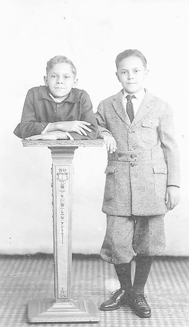 8. На фото Роберт и его брат-близнец Джонни Эк интересно, история, люди-мутанты, мутации, прошлое, фото