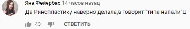 Телезрители заподозрили Собчак в пластике носа под сомнительным предлогом