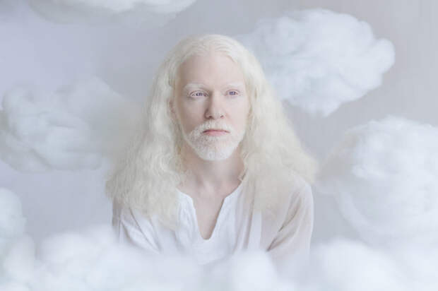Элиран альбиносы, красота, люди, фото, фотограф, фотопроект, цвет кожи