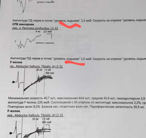 Навальный больше не голодает? Ну вот и славно
