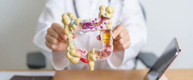 Комбинированное лечение значительно повышает выживаемость при раке кишечника