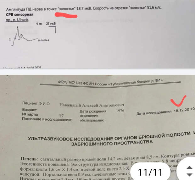 Навальный больше не голодает? Ну вот и славно