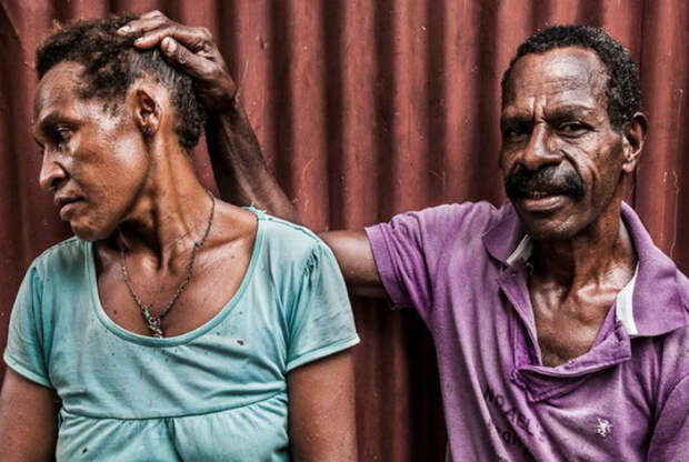 В Новой Гвинеи мужья регулярно избивают своих жен.