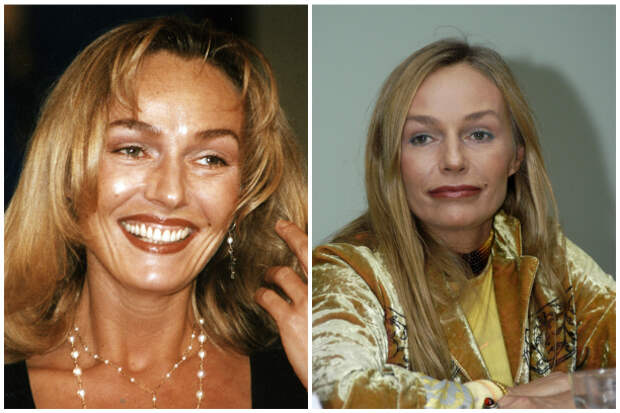 Наталья Андрейченко пластика фото до и после