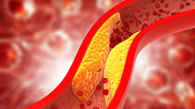 Глюкоза – самое необходимое вещество в питании организма и одновременно самое опасное