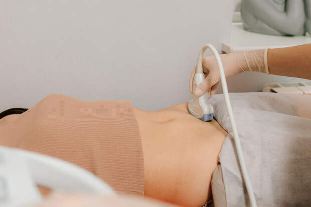 Онколог Румянцев: иногда рак яичников может развиться за несколько месяцев