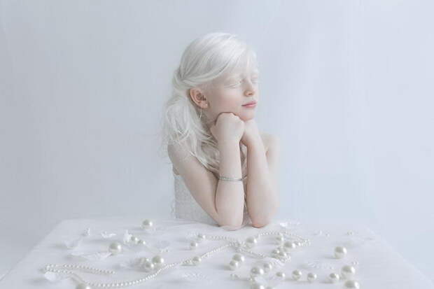 Красота альбиносов в фотографиях Yulia Taits Красота альбиносов в фотографиях Yulia Taits