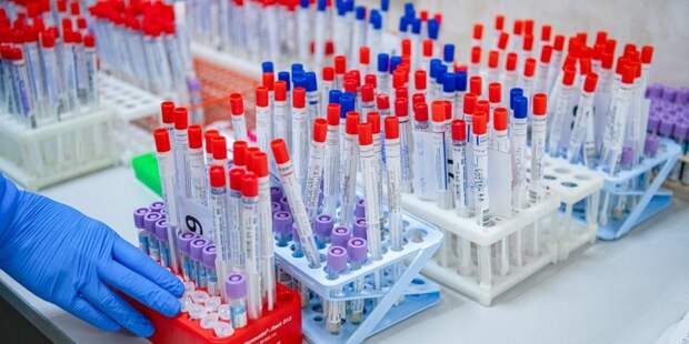 В Москве в сутки проводят 25 тысяч тестов на коронавирус Фото: mos.ru