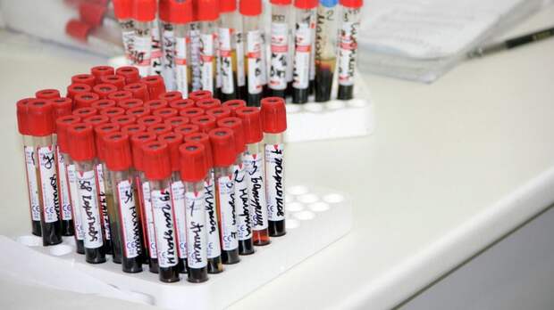 Паровичникова: в России разрабатывают новый метод лечения рака крови