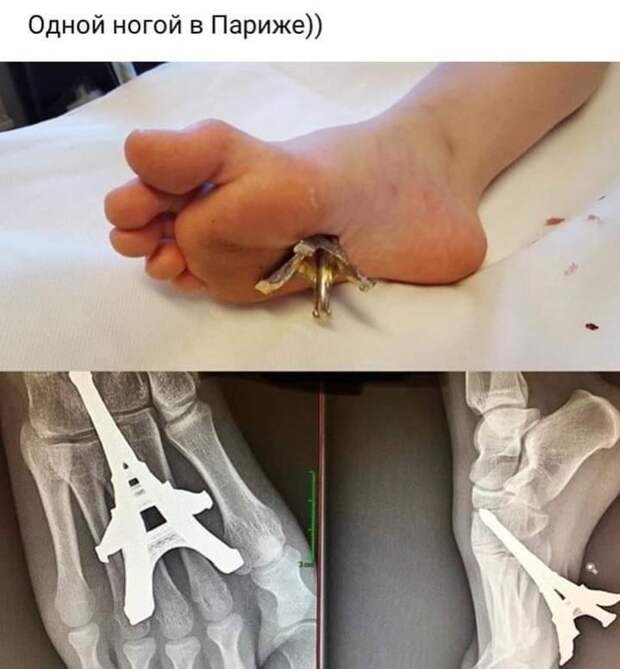 Париж) Париж)
