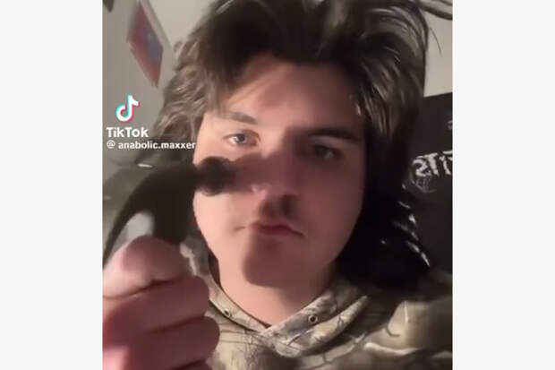 Подростки начали стучать себе по лицу молотком ради идеальной внешности