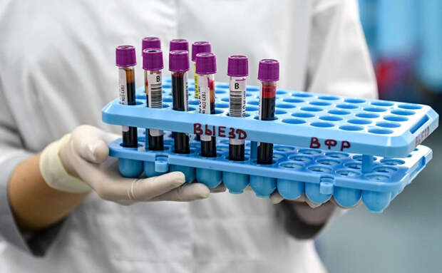 Инфекционист Шахмарданов: Вирус Нипах не представляет опасности для москвичей