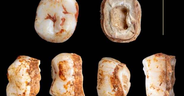 Белки в зубном камне скифов раскрыли их молочные предпочтения и связь с историей