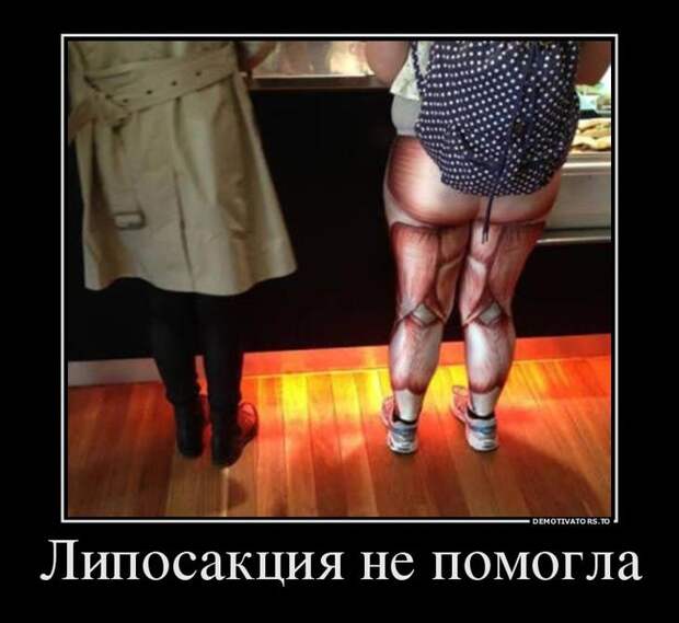 Липосакция не помогла Липосакция не помогла демотиватор, прикол, юмор