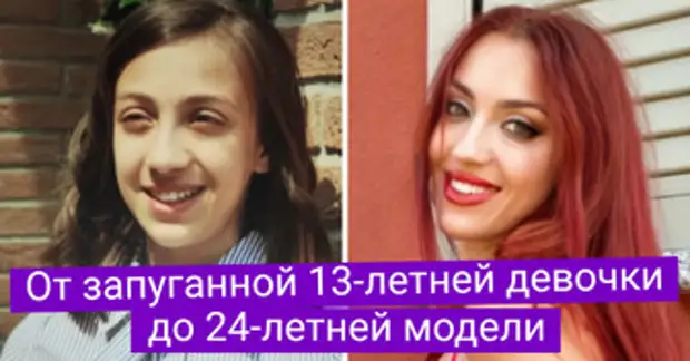 16 «гадких утят», которые взялись за себя и с годами стали краше некуда