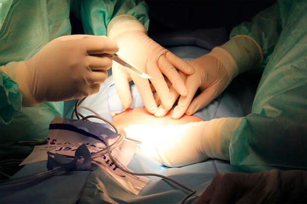 Le Figaro: в прямой кишке 88-летнего француза нашли снаряд времен Первой мировой