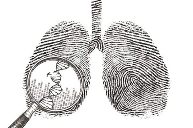 STM: устойчивые клетки рака можно уничтожить, лишив их жиров и глюкозы