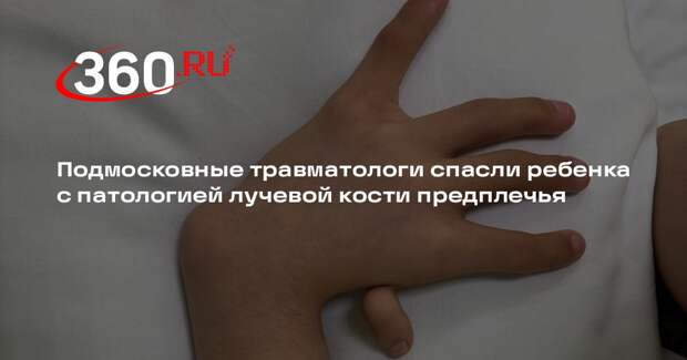 Подмосковные травматологи спасли ребенка с патологией лучевой кости предплечья