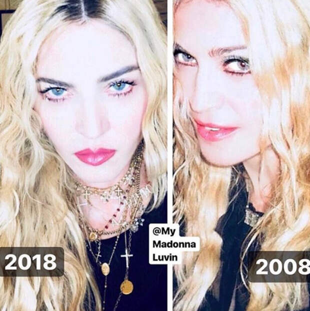 Мадонна в #10YearChallenge