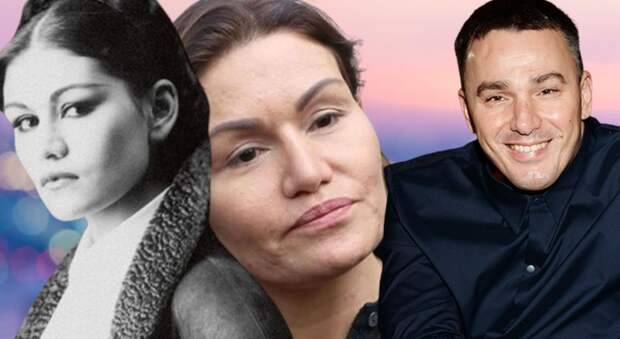 «Выглядит старше мужа»: скандал вокруг пластики жены «Иванушки» и почему её лицо изменилось до неузнаваемости