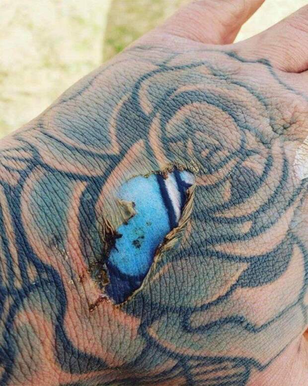 Из-за ожога на руке поблекшая татуировка стала как новенькая 