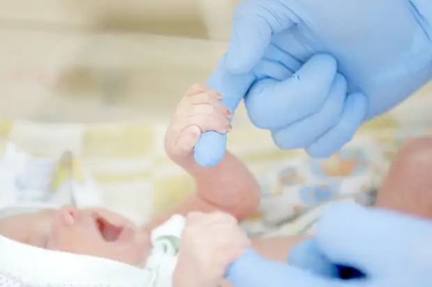 Новорожденных массово проверят на спинальную мышечную атрофию
