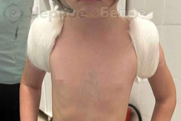 ЧП в парке: малышка сломала ключицу на тюбинге