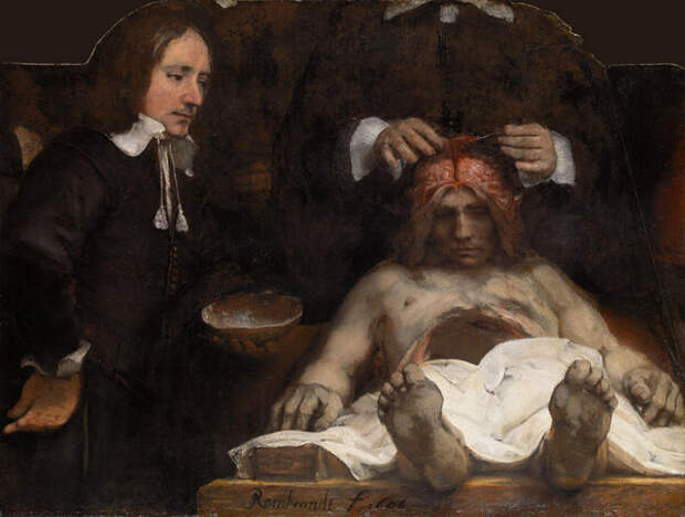 Рембрандт Харменс ван Рейн. Урок анатомии доктора Деймана , 1656