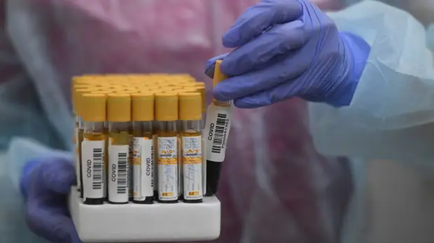 Заммэра Москвы прокомментировала рост заболеваемости COVID-19 в столице