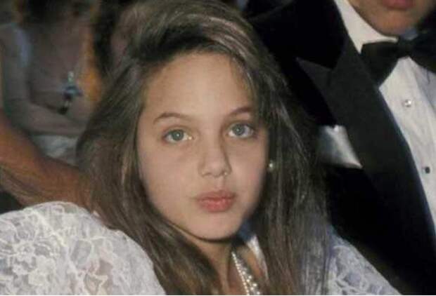 И даже Анжелина Джоли. Школьники издевались над ней из-за её губ. Сегодня многие женщины прибегают к хирургическим вмешательствам, чтобы их губы хоть немного походили на её.