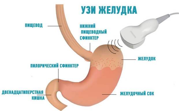 Папиллит желудка: описание, диагностика, профилактика и особенности лечения