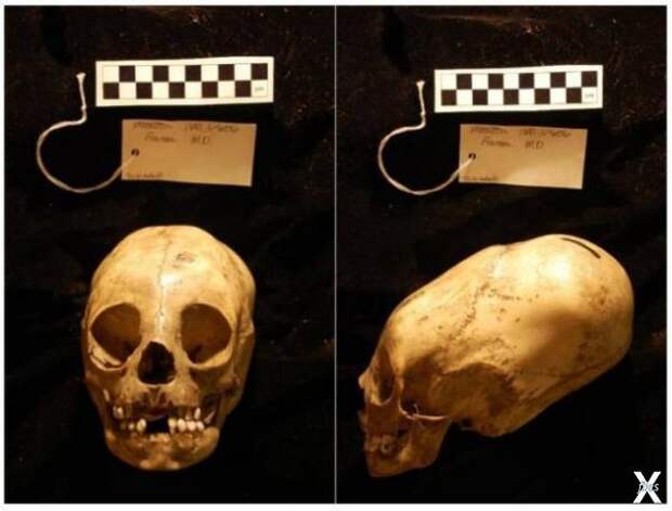 Коллекция Мортона, череп №1681, Музей...