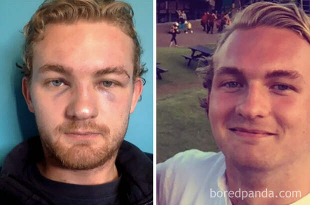 before-after-sobriety-photos-82
