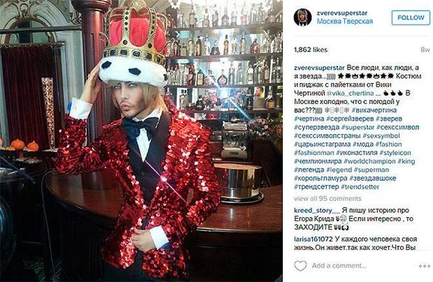 Звезда в шоке Это мы в шоке Сумасшедшие образы Сергея Зверева