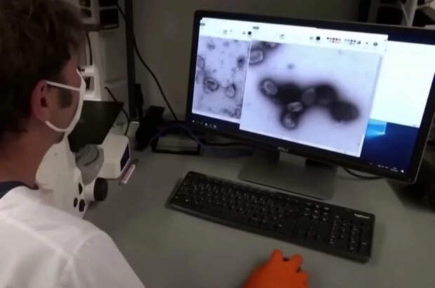 Академик Онищенко: вирус оспы обезьян может стать более заразным