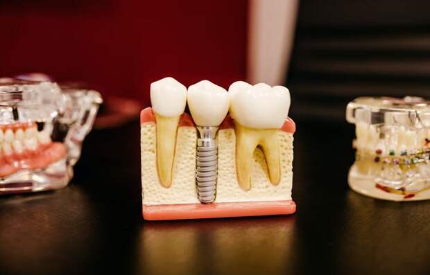 Стоматолог Копылов оценил привычку главы минобороны Израиля открывать бутылки зубами