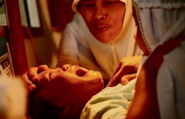Жуткая медицинская практика: женское обрезание.