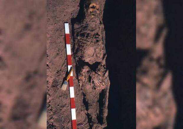 Болезни древних египтян.