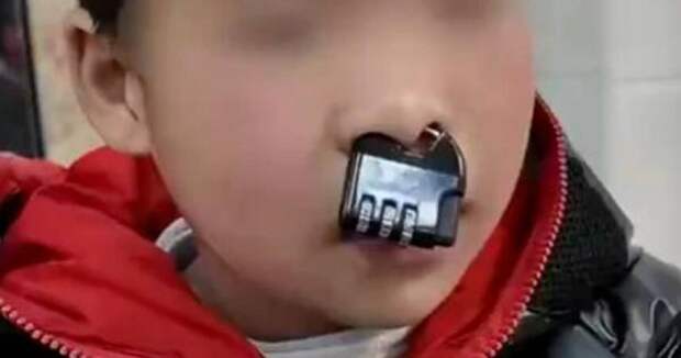 Ребёнок застрял с кодовым замком в носу