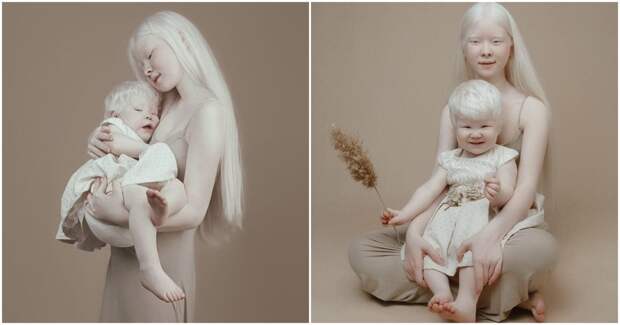 Удивительные сестры-альбиносы из Казахстана поражают мир своей необычной красотой